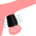 Fijne siliconen balzak ring