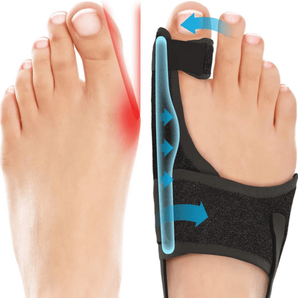 Hallux Valgus Corrector  - Afbeelding 4